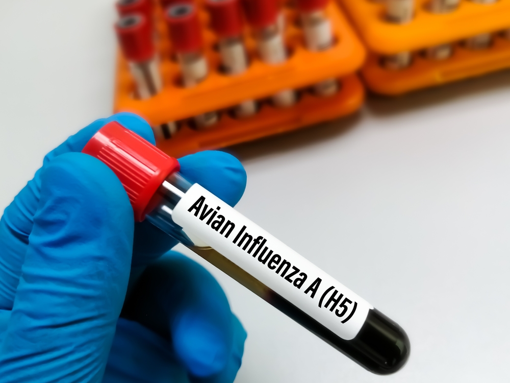 influenza aviaria